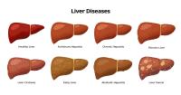 illustrations of liver with fatty liver, hepatitis, fibrosis, cirrhosis, alcoholic hepatitis, liver cancer - medical infographic elements isolated on white background